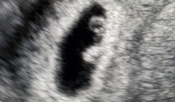 Fertilità