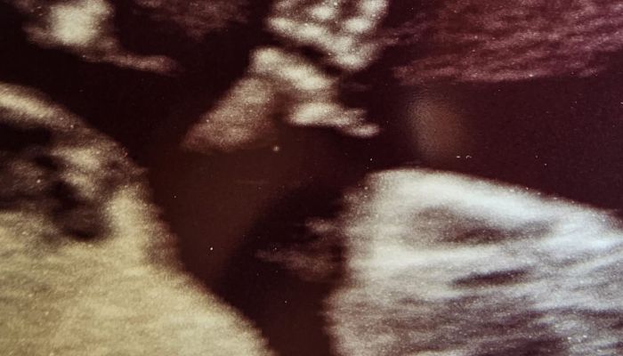 Una bambina di 13 settimane saluta il dr. Florio in ecografia!