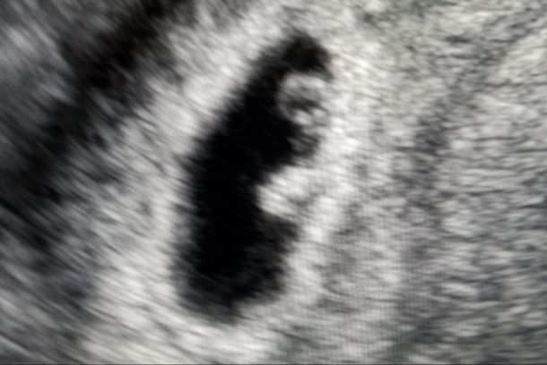 Fertilità