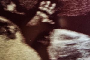 Una bambina di 13 settimane saluta il dr. Florio in ecografia!