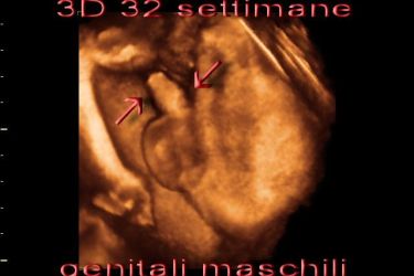 Medicina prenatale