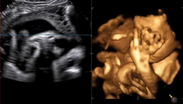 La risposta di un bimbo di 30 settimane alla pandemia e alla guerra