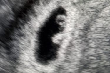 Fertilità